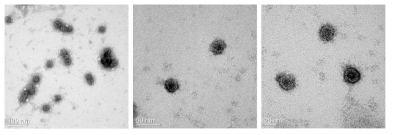 효모세포에서 발현하고 정제한 HPV16 VLP의 전자현미경 결과.
