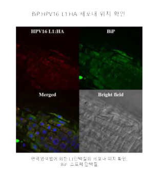 애기장대에서 발현한 HPV16 L1단백질의 세포 내 위치를 면역염색법으로 확인한 결 과.