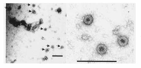 식물체에서 발현된 HPV16 VLP의 전자현미경 관찰 결과