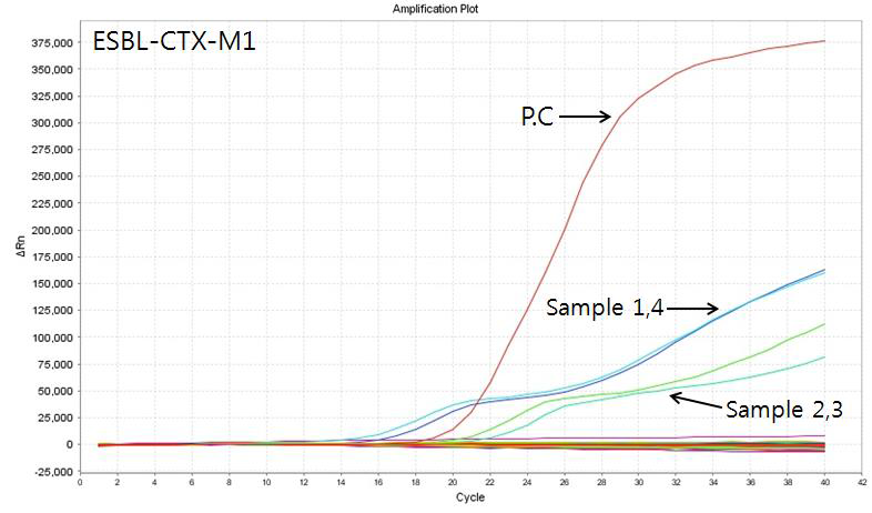ESBL (CTX-M1) 유전자 real-time PCR 결과
