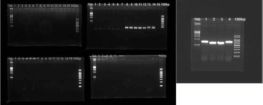 ESBL (CTX-M1) 유전자 conventional PCR 결과
