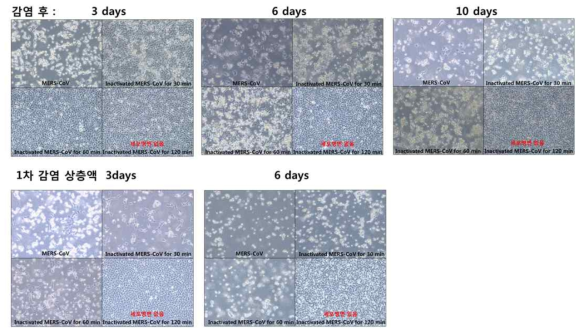 Heat inactivated MERS CoV 감염 후 CPE 조사