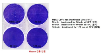 Plaque assay를 통한 MERS CoV 불활화 검증