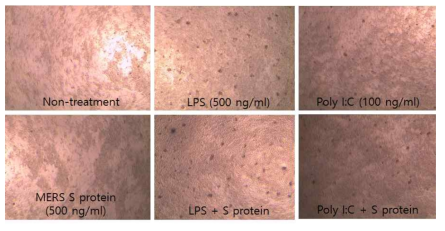 S protein이 splenocytes 세포 모양에 미치는 영향