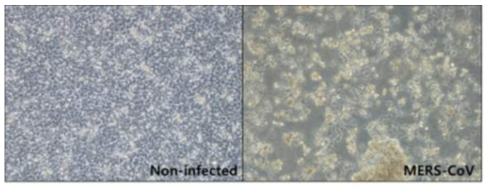 MERS CoV에 의한 세포변성효과(CPE)