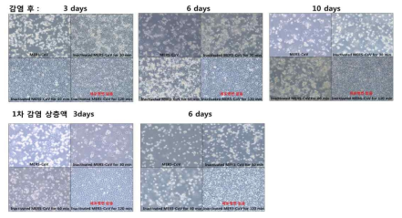 Heat inactivated MERS CoV 감염 후 CPE 조사