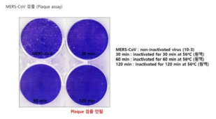 Plaque assay를 통한 MERS CoV 불활화 검증.