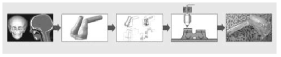 3D 프린팅 기술을 이용한 인공기관 제작 과정