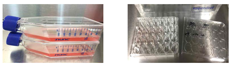 전 배양; 48~72 시간 동안 플라스크에서 배양하여 (왼쪽), 준비된 24-well plate에 세포를 분주한다. (오른쪽).
