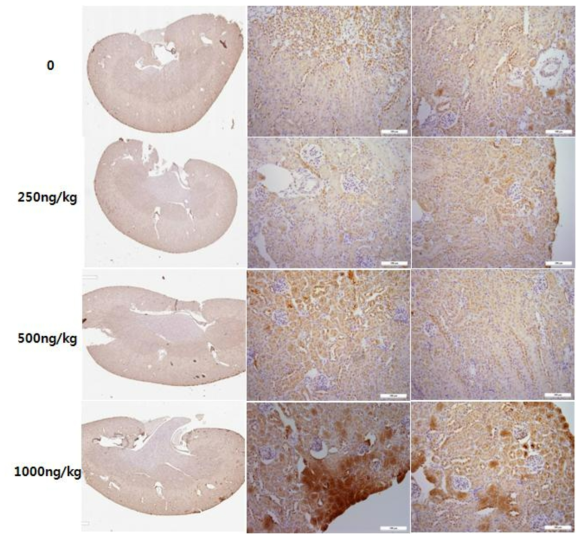 Vitamin D 만성 모델 신장 OPN 발현 관찰