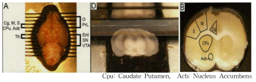 뇌 section 부위