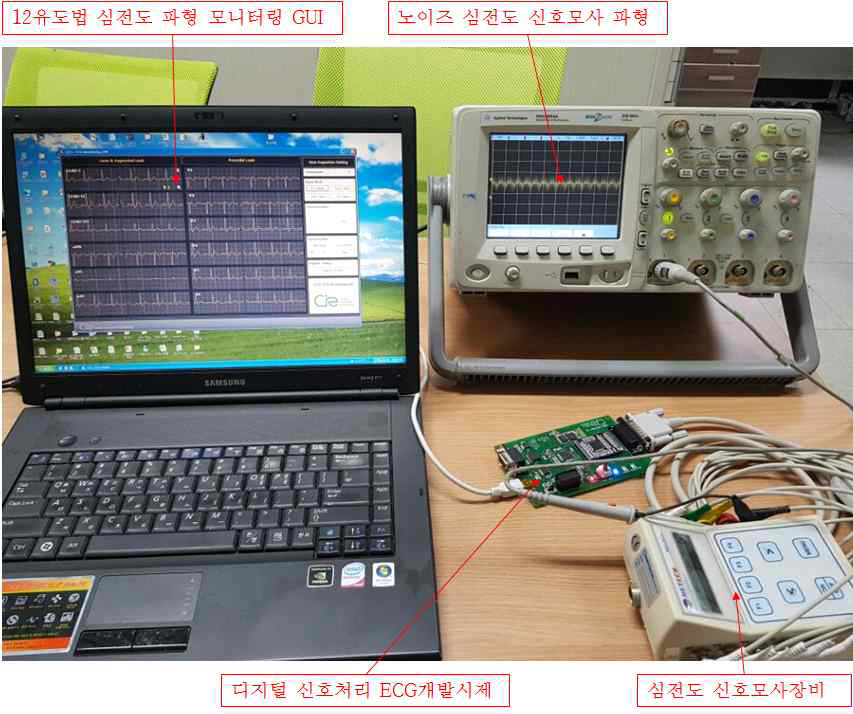 12유도형 무선 ECG 모듈