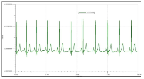 정상상태의 심전도 신호 모의