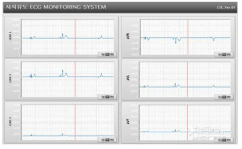 ECG 파형 모니터링 TEST 버전 GUI