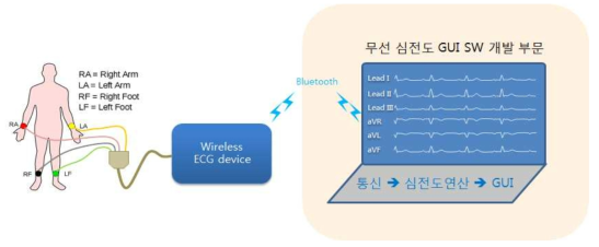 ECG GUI S/W 개발 범위