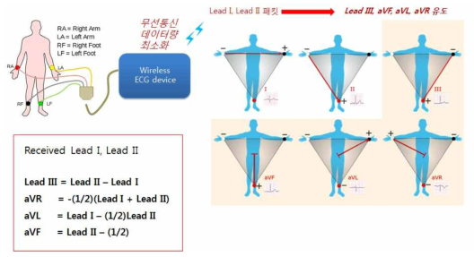 ECG GUI S/W 데이터 처리 기준