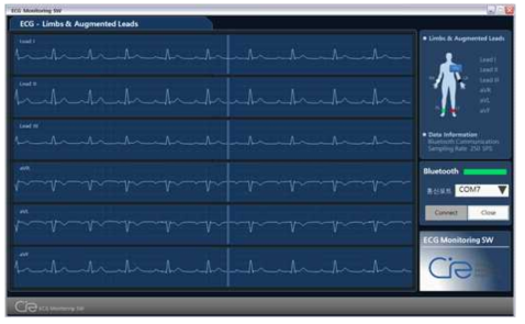 사지유도 유도형 ECG 파형 모니터링 프로그램