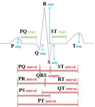 P, QRS complexes, T파로 구성된 한 주기의 심전도에서 기준점 특징 추출