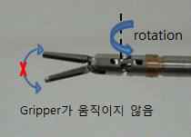 개발된 손목 관절