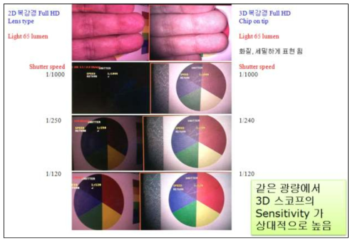 Xenon 광원을 사용하는 lens type 2D복강경과의 조명 밝기 민감도 비교