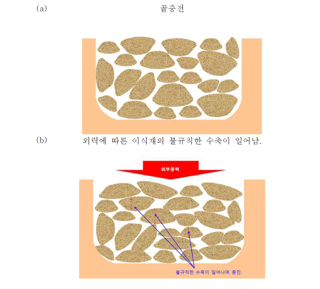 골이식재 충진 과정.