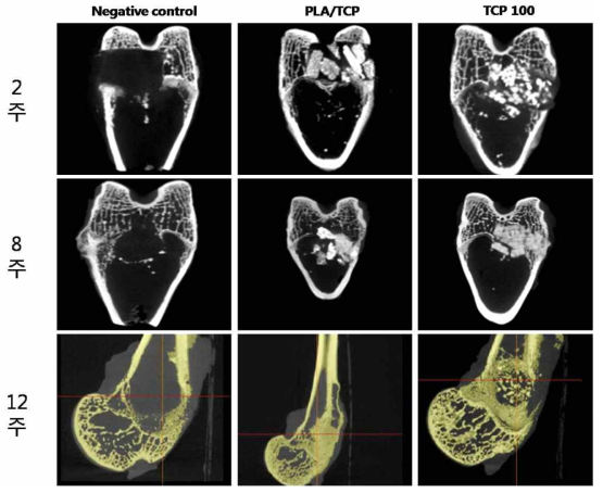 토끼 대퇴골 결손 모델에 이식된 이식재의 X-ray image