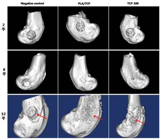 토끼 대퇴골 결손 모델에 이식된 이식재의 Micro-CT image