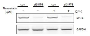 qRT-PCR 로 siRNA transfection 확인