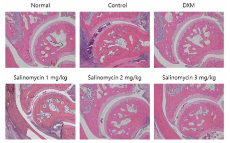 Salinomycin sodium의 관절염 개선 효능 확인