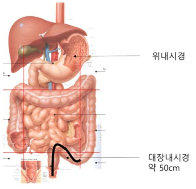 돼지 내시경 위치