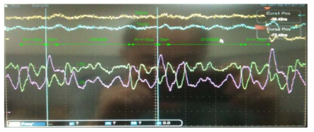 LVDS Interface Waveform