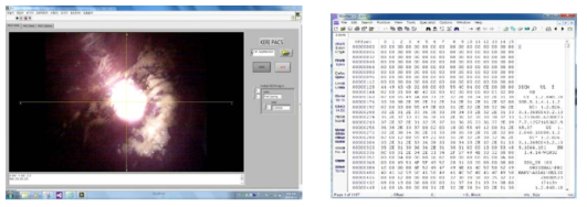 DICOM Converter 및 변환된 파일예