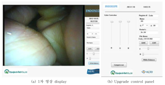 내시경 영상 display 및 영상 contral S/W 화면