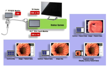 3D 내시경용 컨트롤 스테이션 display 구성도