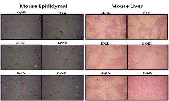 당뇨병 유발 쥐의 epididymal과 liver에서의 지방축적억제효과