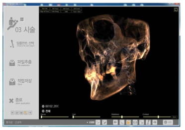 치과용 CBCT에서 획득한 dicom파일을 이용하여 진단 프로그램상에서 구현한 3D 볼륨 이미지