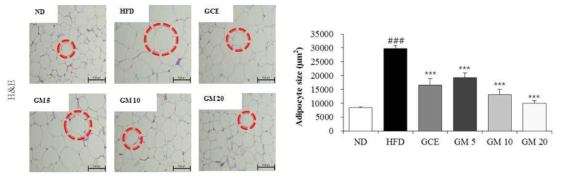 Histological analysis of epididymal adipose tissue in high-fat diet (HFD)-induced obese mice.