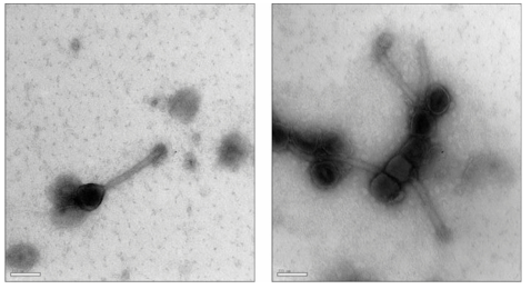TEM으로 촬영한 Staphylococcus aureus Phage SA11 사진