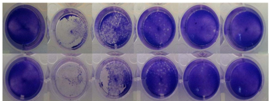 HSV를 이용한 plaque assay 결과