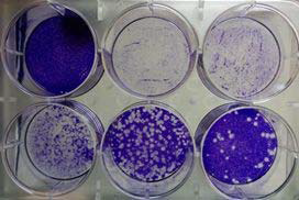 인플루엔자바이러스의 plaque assay 추가실험 결과