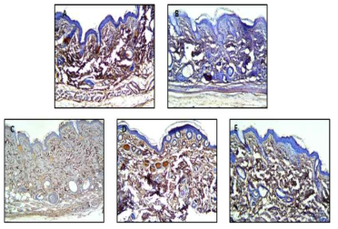 IHC ( MMP- 9) of skin of hairless mouse treated lactulose and bifidobacterium