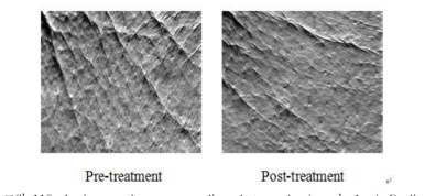 An improved case on replica photography (crow’s feet).