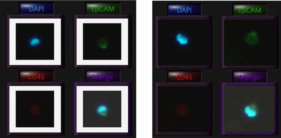 회수 세포로 계수된 세포의 형광 이미지 (OVCAR3)