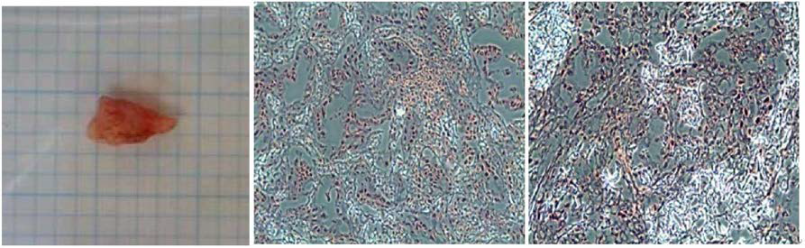 파라핀 block으로 만든 종양조직의 H&E 병리학적 검사결과 예 (40x)