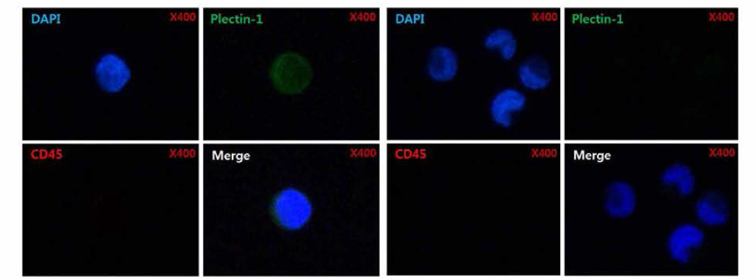 PANC-1 (좌), MIA-PaCa-2 (우) 세포주를 DAPI, Plectin-1, CD45 염색한 결과