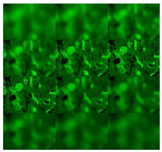 5μm 초점 간격으로 측정한 형광 현미경 이미지