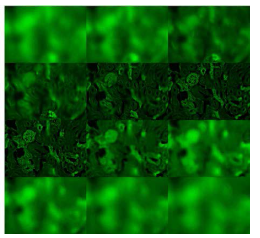 2d-deconvolution 알고리즘을 적용한 초점면 별 형광 이미지，iteration=5