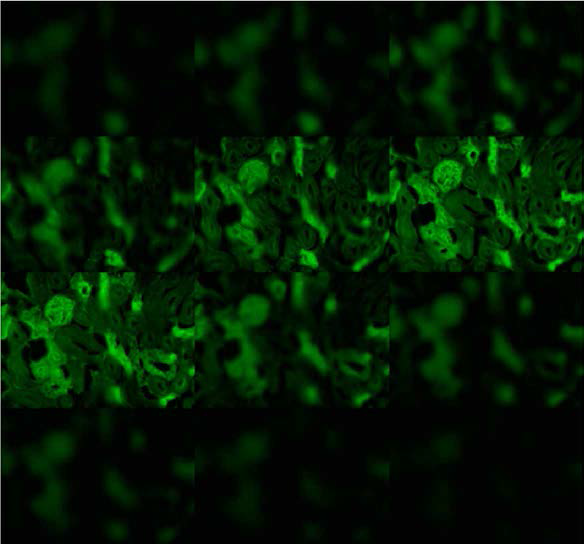개발된 3D-Deconvolution 알고리즘이 적용된 형광 현미경 이미지