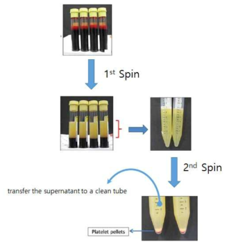 혈액으로부터 혈장 분리 모식도