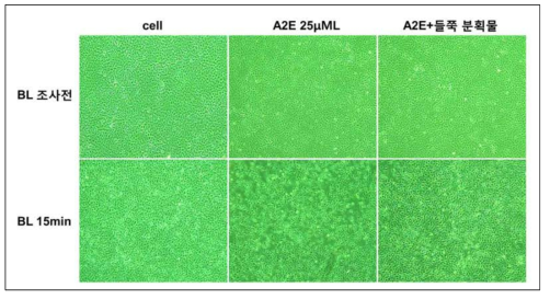 A2E 축적 후 청색광 조사시 산화 스트레스에 대한 효과